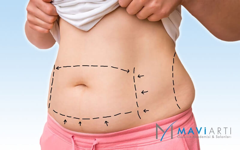 Bodrum Lipoliz, Lipoliz Bodrum Fiyatları, Bodrum Lazer Lipoliz, Bölgesel Zayıflama Fiyatları Bodrum, Lipoliz Yorum, Soğuk Lipoliz Yan Etkileri, Lipoliz Fiyatları 2019, Lazer Lipoliz Fiyatları, Lipoliz Fiyatı Bodrum, Bodrum Lazer Lipoliz, Bodrum Lipoliz Fiyatları, Lipoliz Bodrum, Bodrumda Lipoliz Yapan Yerler, Lipoliz Nedir, Bodrum Lipoliz fiyatları 2024