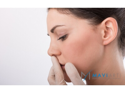 Burun Kaldırma, Bodrum Burun Kaldırma, Bodrum Burun Estetiği, Bodrumda Burun Estetiği Olanlar, Burun Estetiği Fiyatları 2019 Bodrum, Bodrum Burun Estetiği Yapan Hastane, Bodrum Estetik Doktorları, Burun Estetiği Fiyatları Bodrum 2018